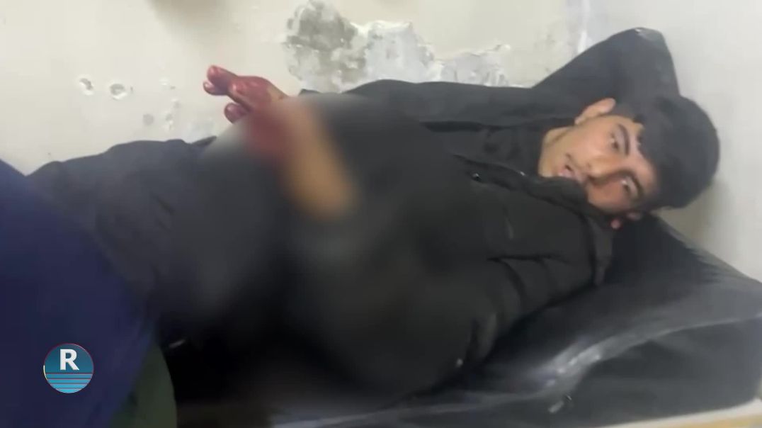 ⁣مشاهد لضحايا مدنيين في الشيخ مقصود والأشرفية جراء قصف مرتزقة الحكومة المؤقتة