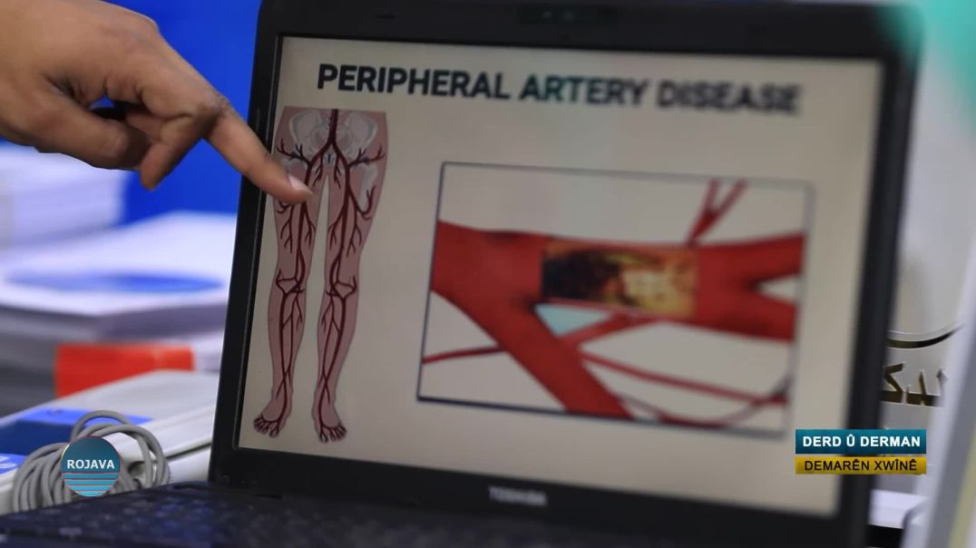 ⁣DERD Û DERMAN ||DEMARÊN XWÎNÊ    || 15 - 2 - 2026