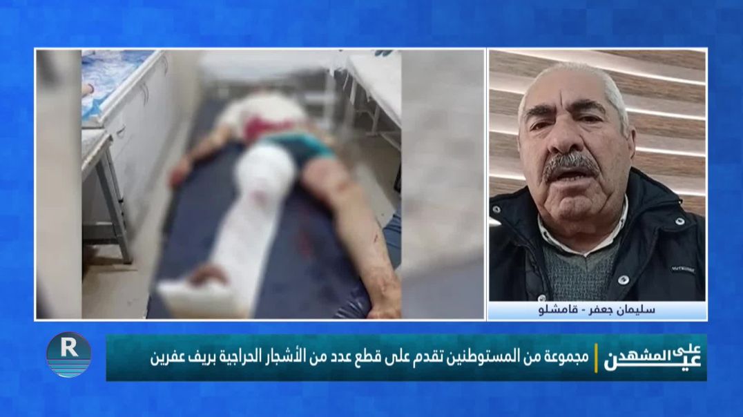 عين على المشهد 31 - 3 - 2026