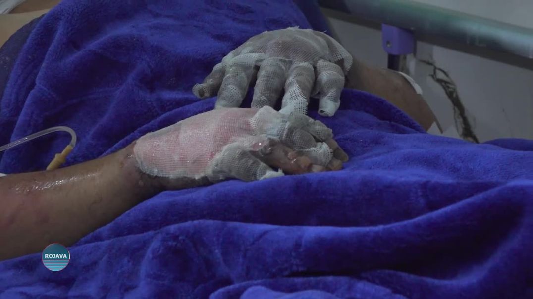 Kamîreya Rojava Tv Rewşa Birîndarên Şewata Girtîgeha Kobanê Şopand